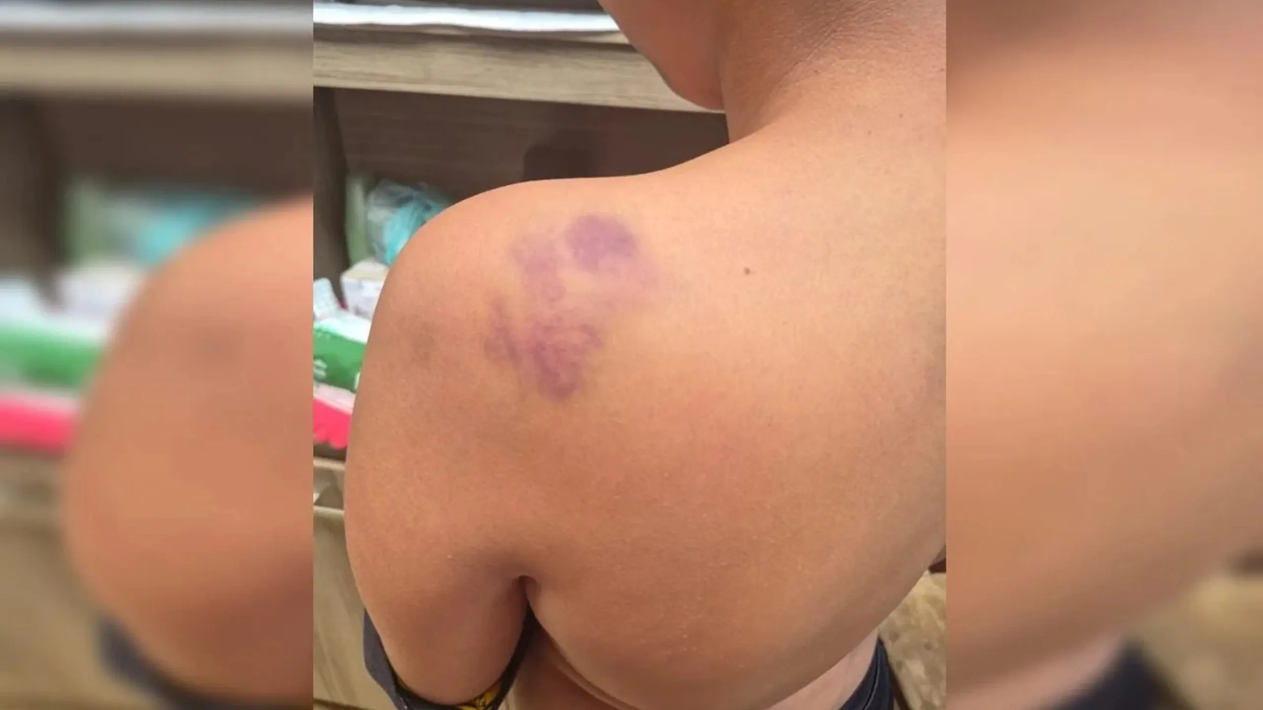 Estudante de 12 anos é espancado após ofensas racistas em escola do DF